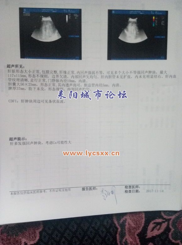 a24690ef76c6a7ef5bc435bdf6faaf51f2de6626.jpg
