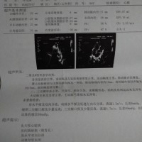 ΢ͼƬ_20180505184032.jpg
